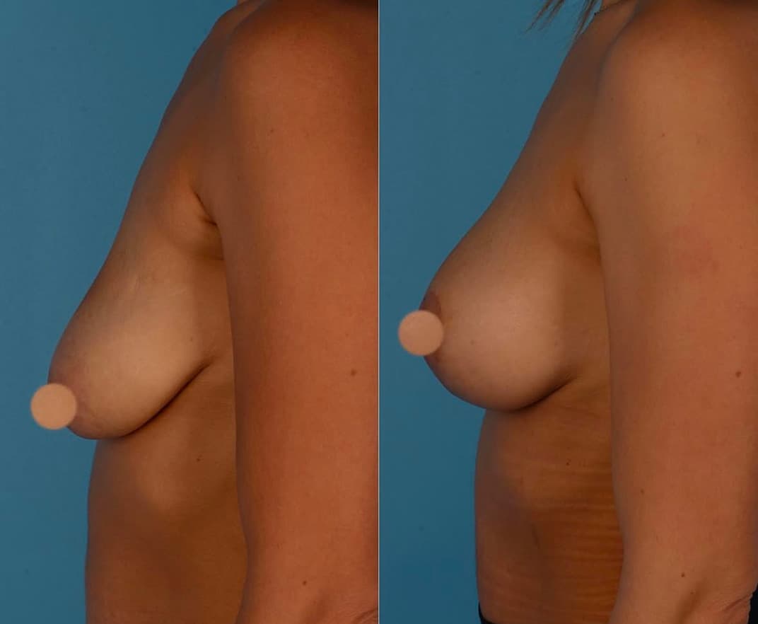 Before and After Photos