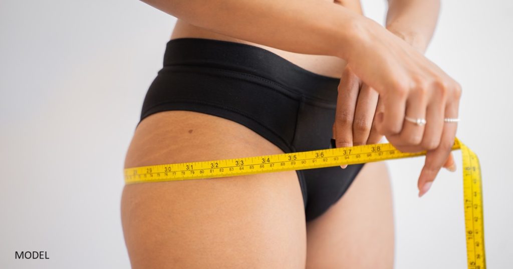 Woman measuring her hips and considering liposuction