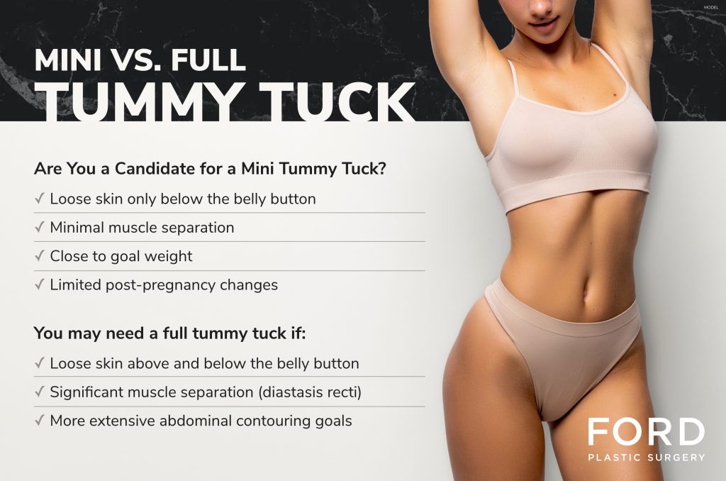 Infographic by Ford Plastic Surgery titled Mini vs. Full Tummy Tuck.