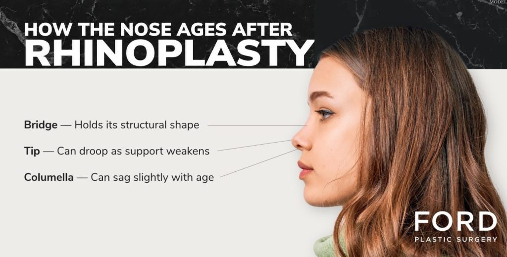 Infographic explaining how the nose may change with age after rhinoplasty, highlighting the bridge, tip, and columella on a side-profile image of a woman.